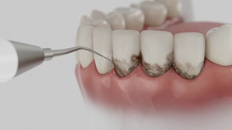 Reliable Emergency Dentist contractor in Macon, MS by Smile Center Dentistry